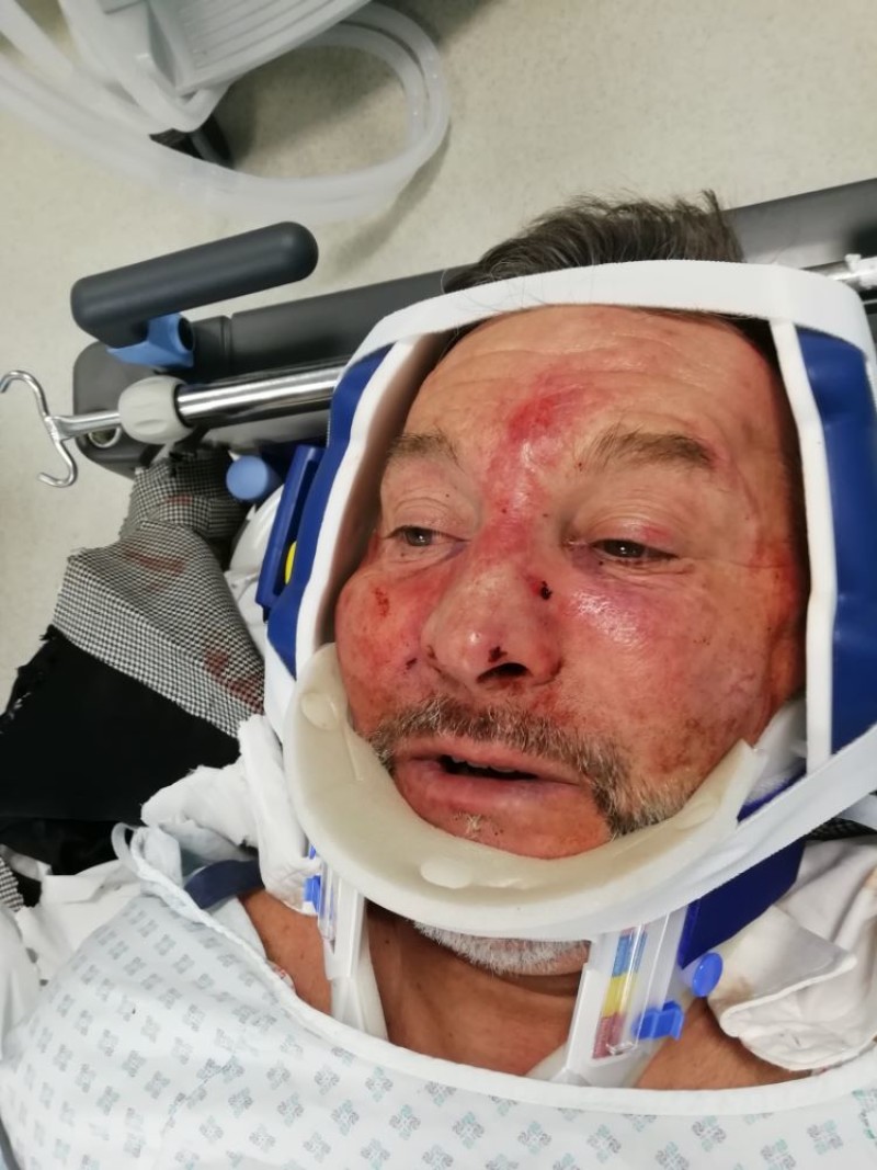 Other image for Ex-Red Ian is still on the mend from attack